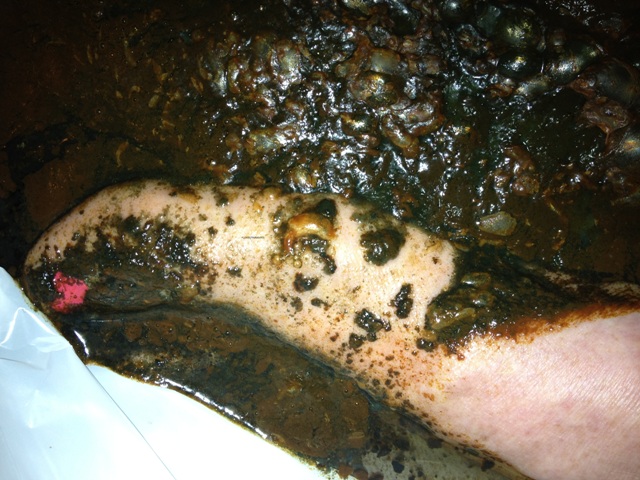 Detox Bath Parasites ionic foot detox ionic foot detox worms Detox Bath Parasites ionic foot detox ionic foot detox worms